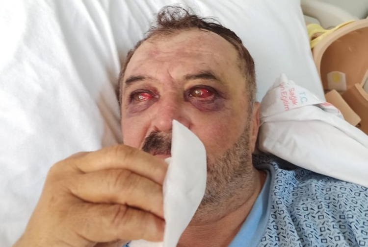 The bloody consequences of Turkey’s clashes with the Kurds