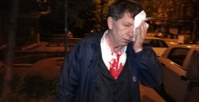Turkish journalists facing unprecedented surge of physical assaults